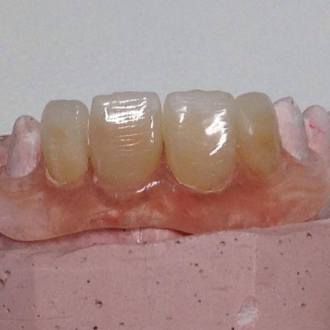 Dental Care - Lavori